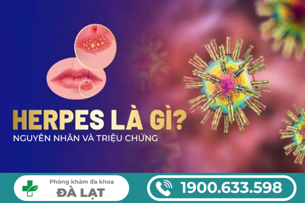 Hình ảnh minh họa